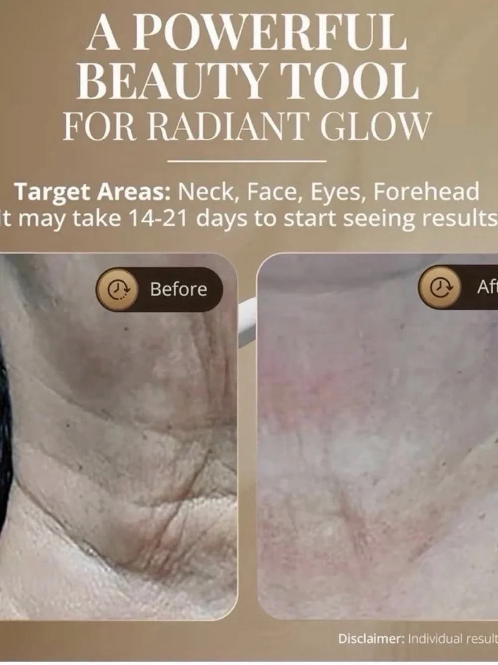 Rose Gold Neck & Face Massager with LED Therapy